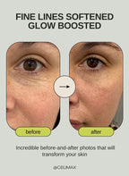 Retinal Shot Tightening Booster